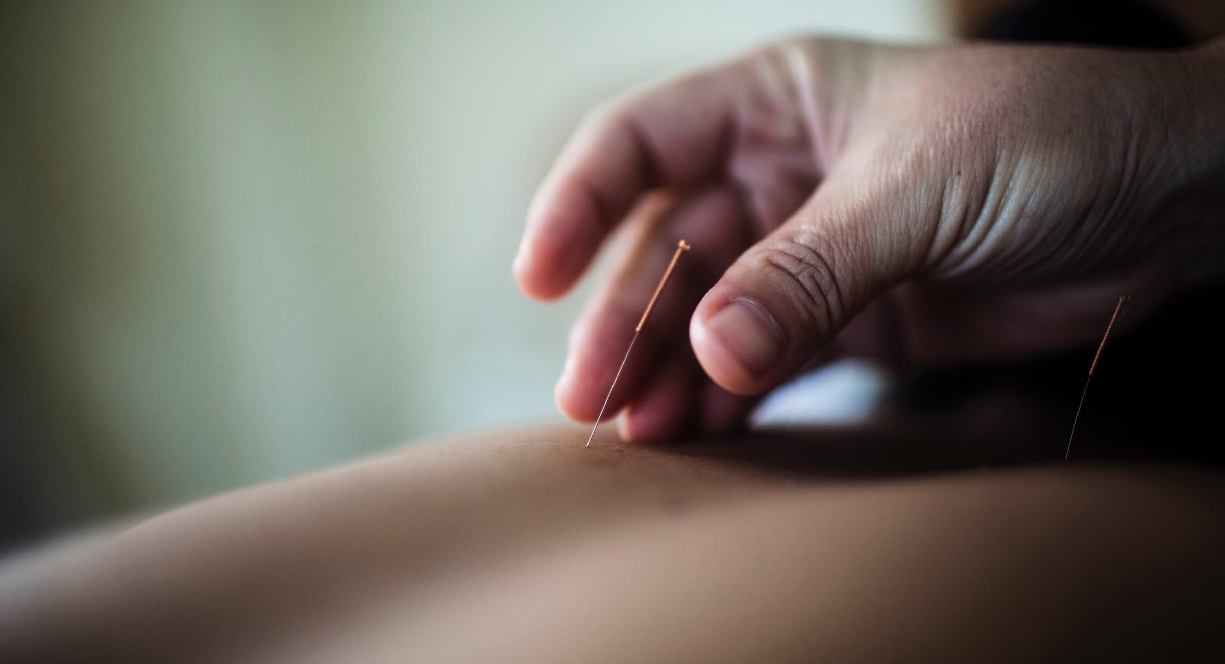 Photo of a woman undertaking dry needling